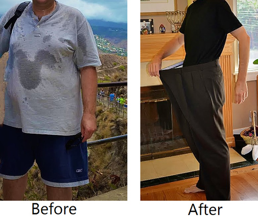 before-after-weight-loss